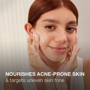 Neutrogena - Gel Hidratante Para Piel Acneica, 141 G Tipo De Piel Con Tendencia Acneica - Image 3