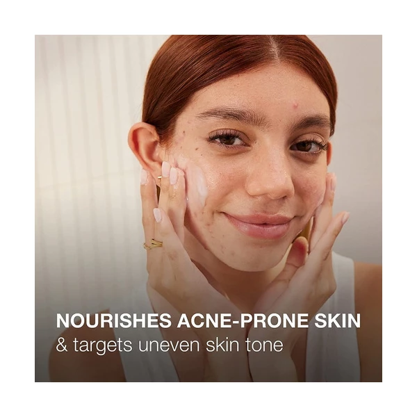 Neutrogena - Gel Hidratante Para Piel Acneica, 141 G Tipo De Piel Con Tendencia Acneica - Image 3