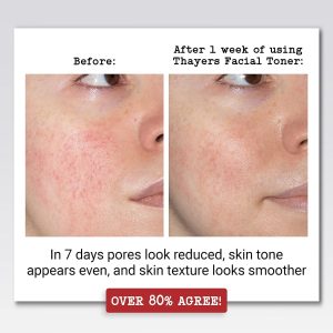 Thayers-tónico Facial, Rosas, Pepino Y Lavanda, Pack 3, 89ml Tipo De Piel Todo Tipo De Piel - Image 4