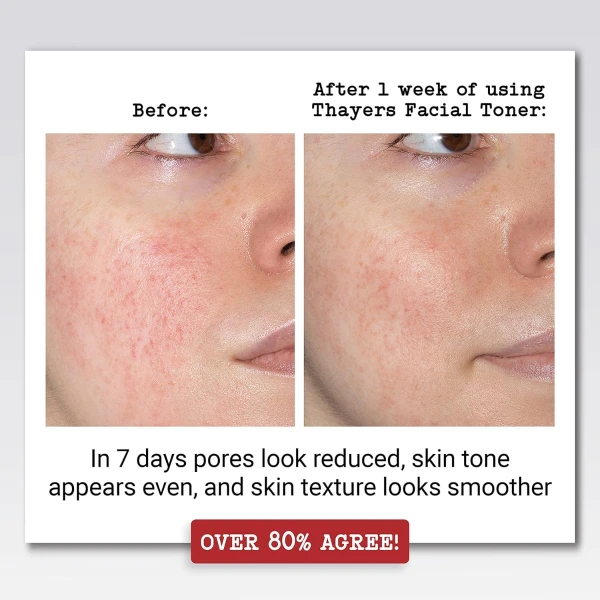 Thayers-tónico Facial, Rosas, Pepino Y Lavanda, Pack 3, 89ml Tipo De Piel Todo Tipo De Piel - Image 4