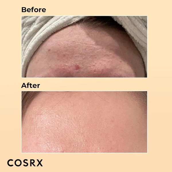Cosrx - Serum Rostro Advanced Con Esencia De Mucina Tipo De Piel Tendenciaacnéica - Image 4