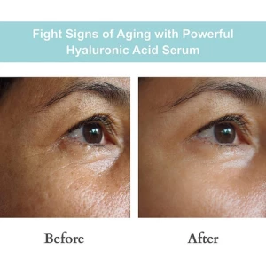 Joyal Beauty Sérum De Ácido Hialurónico Para Cara Natural Tipo De Piel Todo Tipo De Piel - Image 3