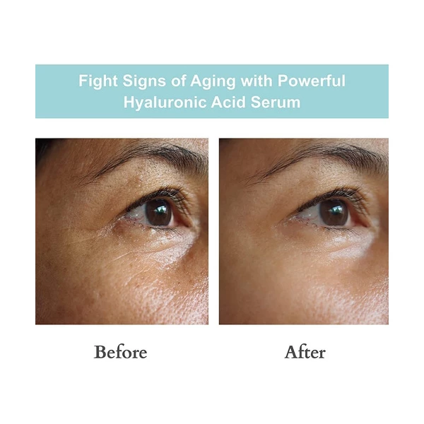 Joyal Beauty Sérum De Ácido Hialurónico Para Cara Natural Tipo De Piel Todo Tipo De Piel - Image 3