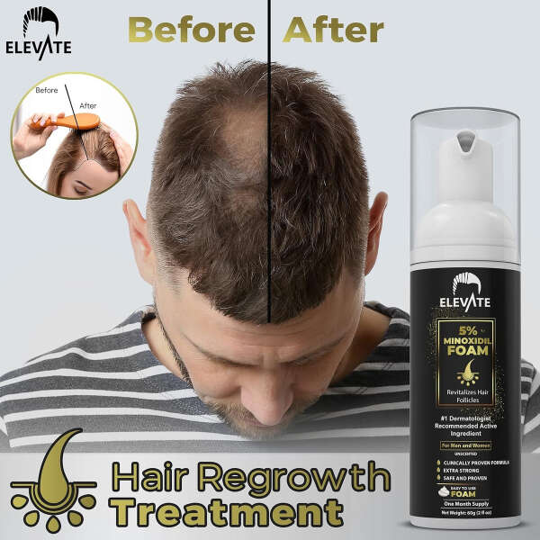 Espuma De Minoxidil 5% Para La Pérdida Del Cabello 3 Und - Image 2