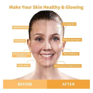 Anairui Máscara Facial Con Vitamina C Y Cúrcuma Control Acné Tipo De Piel Todo Tipo De Piel - Image 5