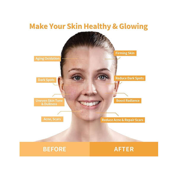 Anairui Máscara Facial Con Vitamina C Y Cúrcuma Control Acné Tipo De Piel Todo Tipo De Piel - Image 5