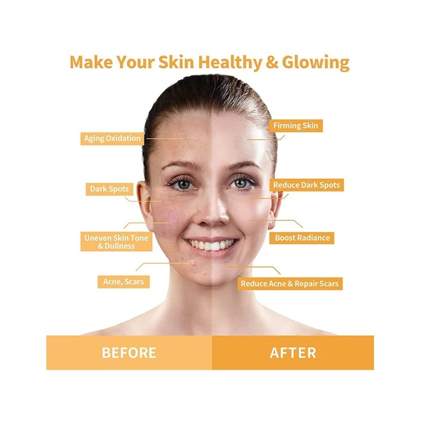 Anairui Máscara Facial Con Vitamina C Y Cúrcuma Control Acné Tipo De Piel Todo Tipo De Piel - Image 5
