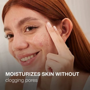 Neutrogena - Gel Hidratante Para Piel Acneica, 141 G Tipo De Piel Con Tendencia Acneica - Image 5