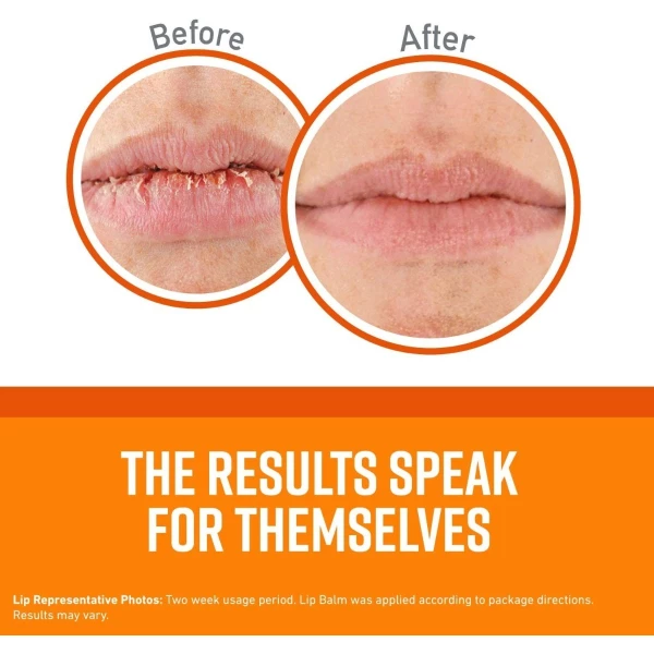 O'keeffe's Bálsamo Labial Reparador De Labios Pack 3 - Image 3