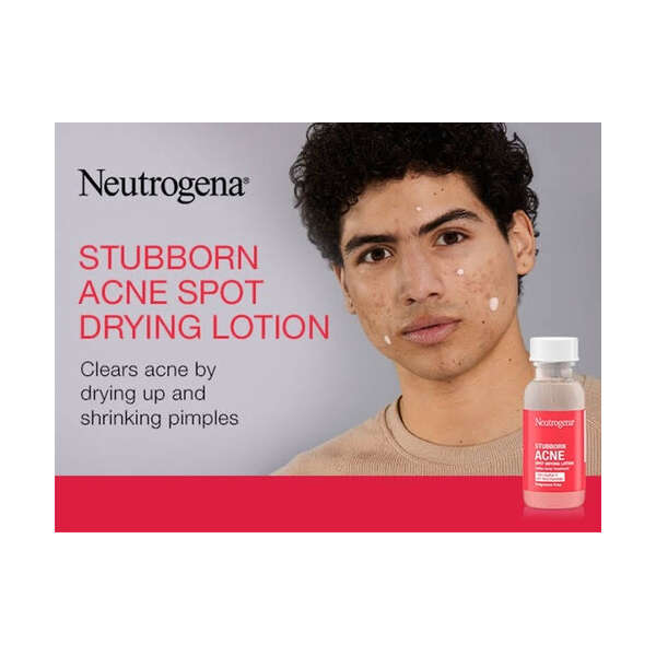 Neutrogena- Loción De Secado Para Manchas De Acné 29ml Tipo De Piel Todo Tipo De Piel - Image 2