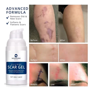 Gel Cicatrizante De Silicona Para Cicatrices Viejas Y Nuevas - Image 3