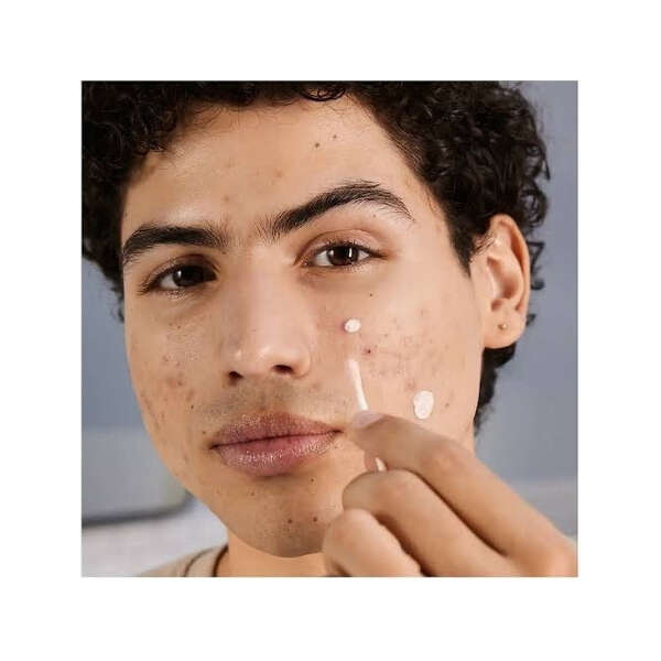 Neutrogena- Loción De Secado Para Manchas De Acné 29ml Tipo De Piel Todo Tipo De Piel - Image 4