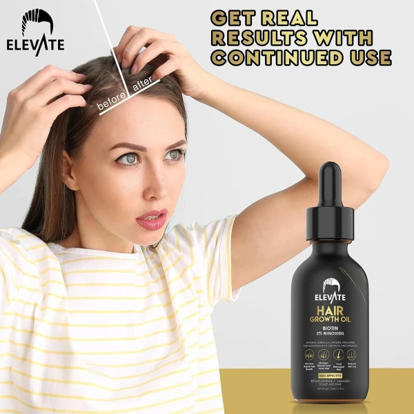 Elevate- Aceite Para El Crecimiento Del Cabello Biotina 30ml - Image 4